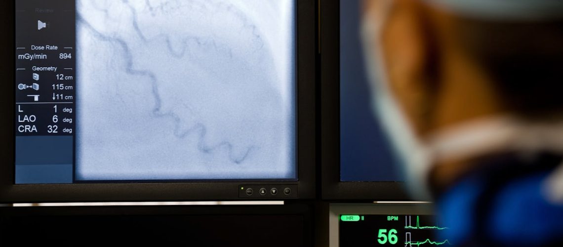 Tout savoir sur l’artériographie Tout savoir sur l'artériographie