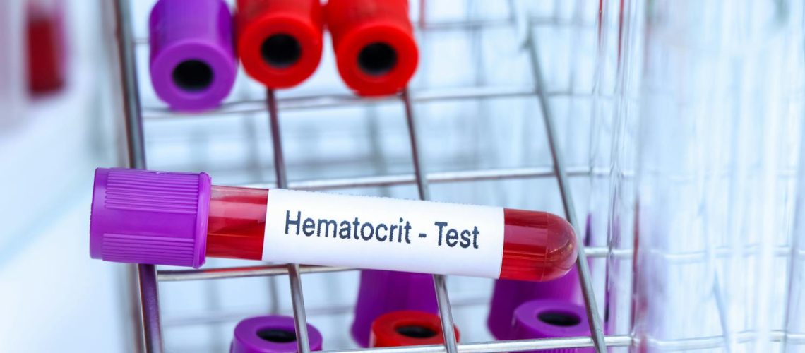 Qu’est-ce que l’hématocrite ? Qu'est-ce que l'hématocrite ?