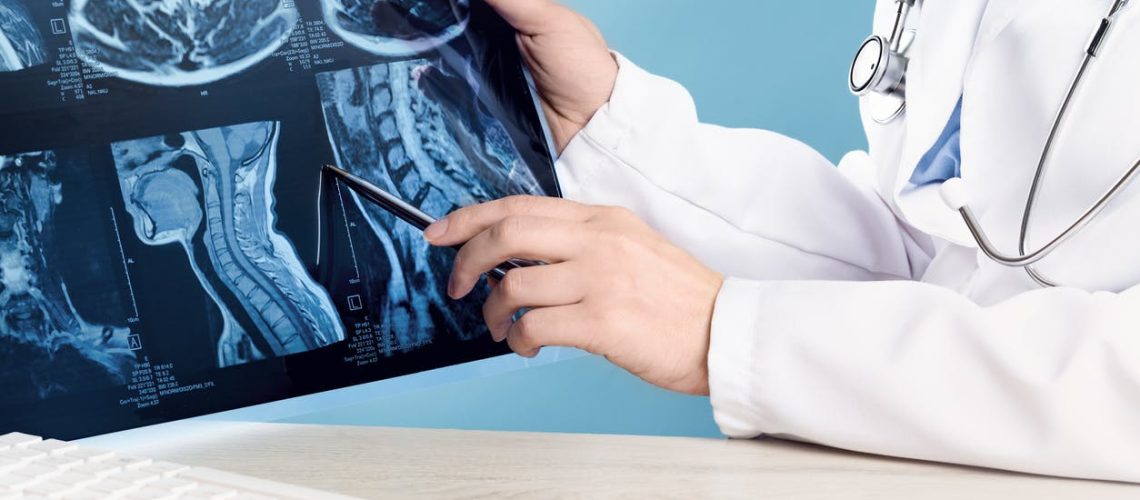 Tout savoir sur la moelle épinière Tout savoir sur la moelle épinière