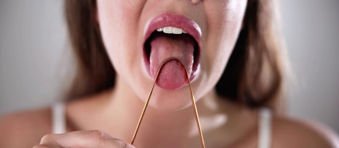 Langue fissurée : causes, symptômes, c’est grave ? Langue fissurée : causes, symptômes, c'est grave ?
