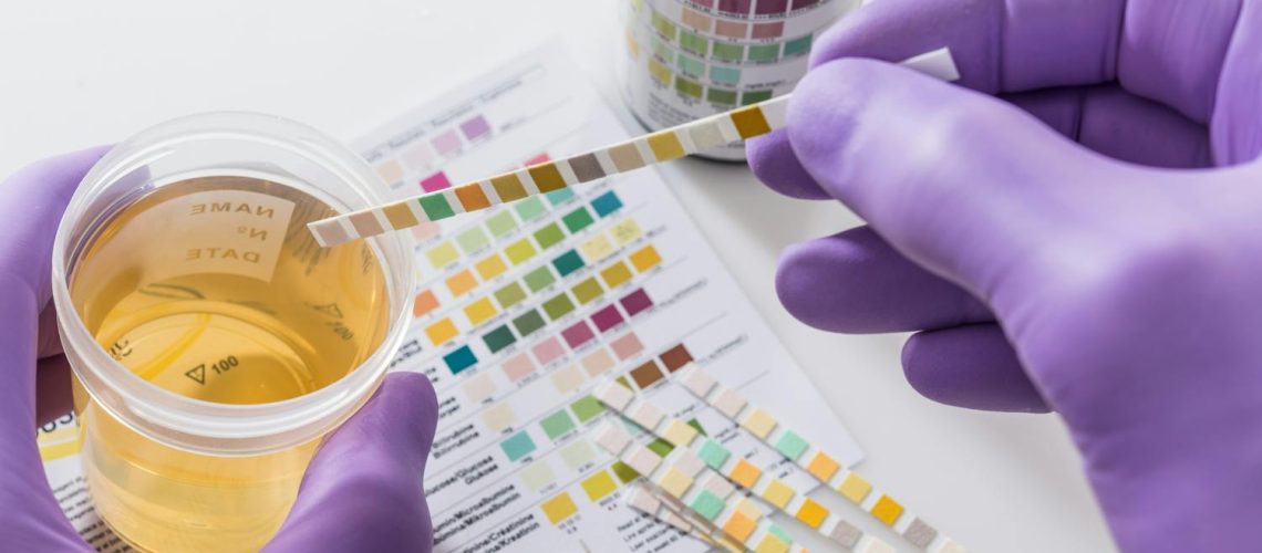 Du sang dans les urines : faut-il s’inquiéter ? Du sang dans les urines : faut-il s'inquiéter ?