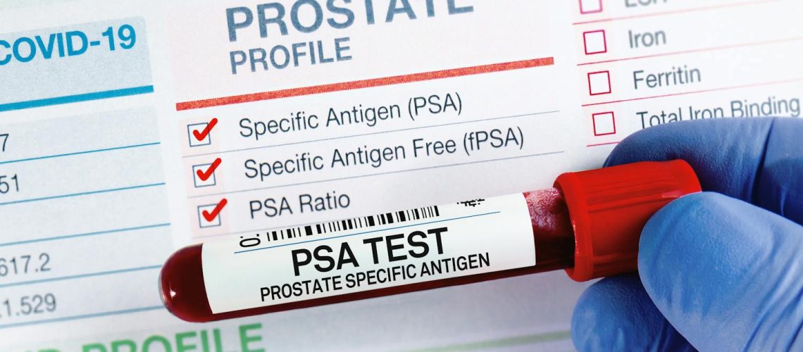 Prostate : pourquoi faut-il surveiller son taux de PSA ? Prostate : pourquoi faut-il surveiller son taux de PSA ?